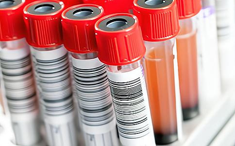 RFID電子標簽讀寫器與天線用于智能試劑柜和生物樣本柜管理方案